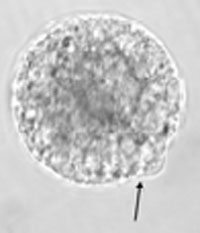 meiosis: a big gray circle, mottled, with a tiny rounded bump on one side