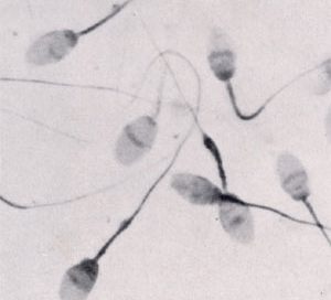 sperm cells: gray oval translucent cells with long thin tails (flagella)