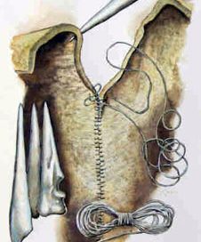 drawing of an awl, thread, stitching on leather