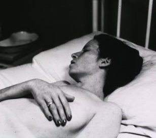 A white woman with typhus
